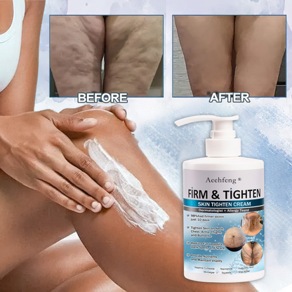 👨‍⚕️𝐀𝐞𝐞𝐡𝐟𝐞𝐧𝐠™ 𝐅𝐢𝐫𝐦 𝐓𝐢𝐠𝐡𝐭𝐞𝐧 𝐒𝐤𝐢𝐧 𝐓𝐢𝐠𝐡𝐭𝐞𝐧 𝐂𝐫𝐞𝐚𝐦🔥 (𝐑𝐞𝐜𝐨𝐦𝐦𝐞𝐧𝐝𝐞𝐝 𝐛𝐲 𝐀𝐀𝐃)  (👩‍⚕️𝐃𝐞𝐫𝐦𝐚𝐭𝐨𝐥𝐨𝐠𝐢𝐬𝐭 𝐑𝐞𝐜𝐨𝐦𝐦𝐞𝐧𝐝𝐞𝐝)