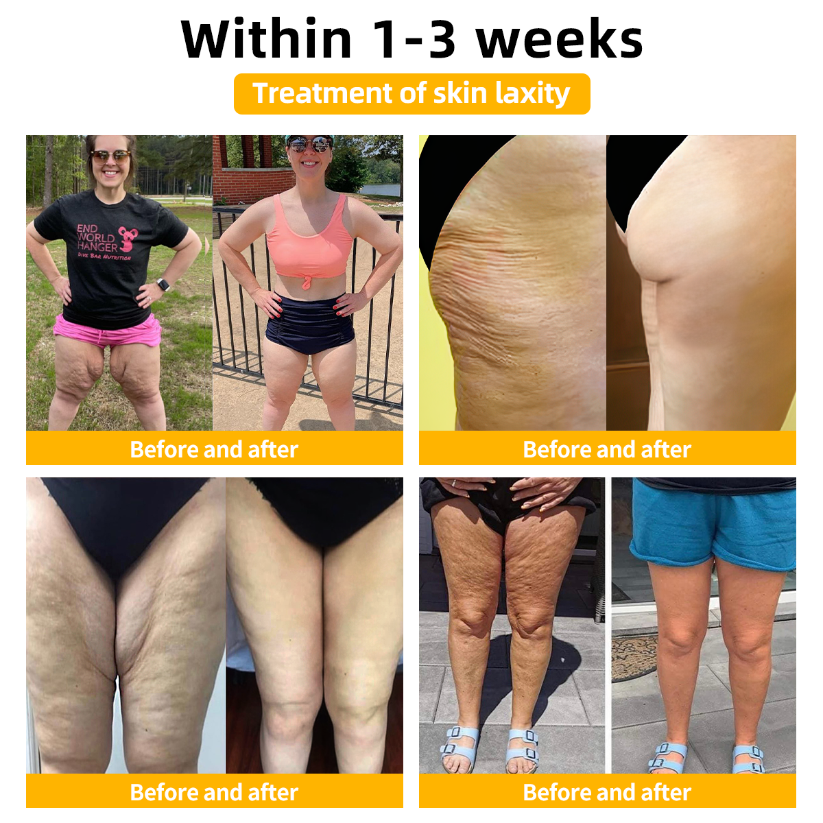 👨‍⚕️𝐀𝐞𝐞𝐡𝐟𝐞𝐧𝐠™ 𝐅𝐢𝐫𝐦 𝐓𝐢𝐠𝐡𝐭𝐞𝐧 𝐒𝐤𝐢𝐧 𝐓𝐢𝐠𝐡𝐭𝐞𝐧 𝐂𝐫𝐞𝐚𝐦🔥 (𝐑𝐞𝐜𝐨𝐦𝐦𝐞𝐧𝐝𝐞𝐝 𝐛𝐲 𝐀𝐀𝐃)  (👩‍⚕️𝐃𝐞𝐫𝐦𝐚𝐭𝐨𝐥𝐨𝐠𝐢𝐬𝐭 𝐑𝐞𝐜𝐨𝐦𝐦𝐞𝐧𝐝𝐞𝐝)
