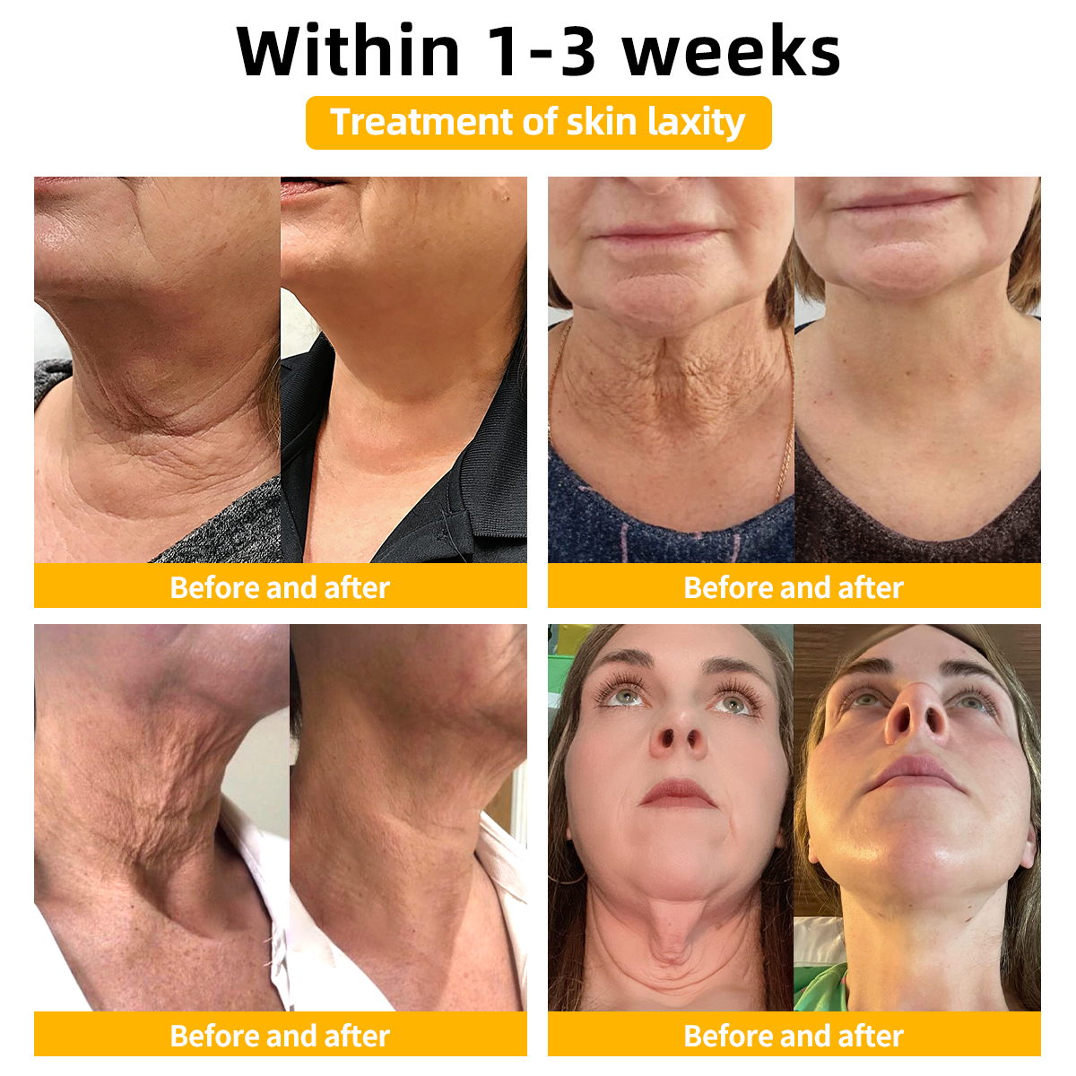 👨‍⚕️𝐀𝐞𝐞𝐡𝐟𝐞𝐧𝐠™ 𝐅𝐢𝐫𝐦 𝐓𝐢𝐠𝐡𝐭𝐞𝐧 𝐒𝐤𝐢𝐧 𝐓𝐢𝐠𝐡𝐭𝐞𝐧 𝐂𝐫𝐞𝐚𝐦🔥 (𝐑𝐞𝐜𝐨𝐦𝐦𝐞𝐧𝐝𝐞𝐝 𝐛𝐲 𝐀𝐀𝐃)  (👩‍⚕️𝐃𝐞𝐫𝐦𝐚𝐭𝐨𝐥𝐨𝐠𝐢𝐬𝐭 𝐑𝐞𝐜𝐨𝐦𝐦𝐞𝐧𝐝𝐞𝐝)
