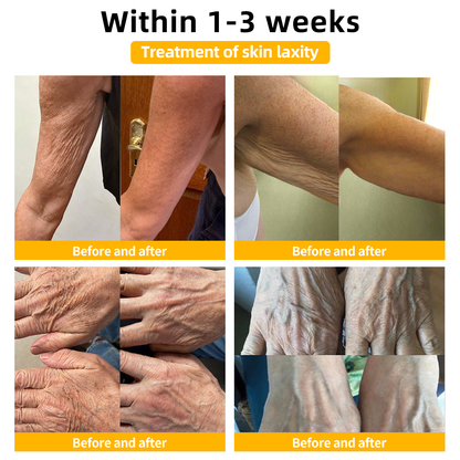👨‍⚕️𝐀𝐞𝐞𝐡𝐟𝐞𝐧𝐠™ 𝐅𝐢𝐫𝐦 𝐓𝐢𝐠𝐡𝐭𝐞𝐧 𝐒𝐤𝐢𝐧 𝐓𝐢𝐠𝐡𝐭𝐞𝐧 𝐂𝐫𝐞𝐚𝐦🔥 (𝐑𝐞𝐜𝐨𝐦𝐦𝐞𝐧𝐝𝐞𝐝 𝐛𝐲 𝐀𝐀𝐃)  (👩‍⚕️𝐃𝐞𝐫𝐦𝐚𝐭𝐨𝐥𝐨𝐠𝐢𝐬𝐭 𝐑𝐞𝐜𝐨𝐦𝐦𝐞𝐧𝐝𝐞𝐝)